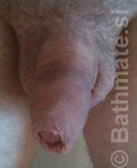 Mišljenja - penis - prije